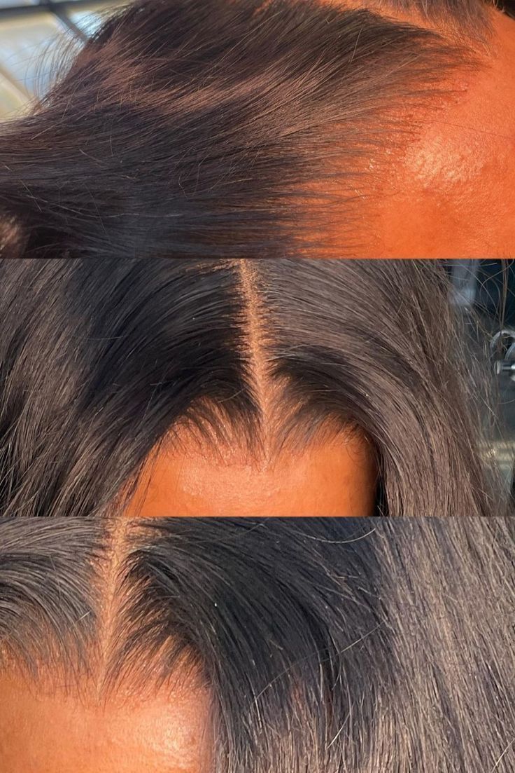 Lace frontale et Closures HD