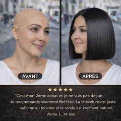 Avant après perruque cheveux naturels alopécie BEL'HAIR Paris - avis client Asma